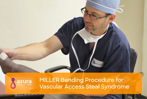 MILLER Banding Procedure for Vascular Access Steal Syndrome