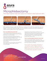 Microphlebectomy fact sheet image