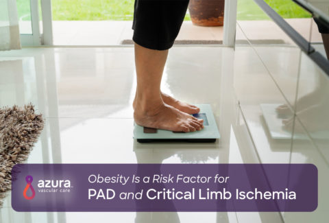 Obesity Is a Risk Factor for PAD and Critical Limb Ischemia main image