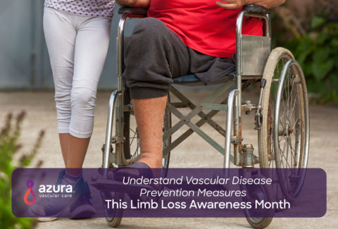 Understand Vascular Disease Prevention Measures This Limb Loss Awareness Month main image