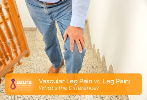 Vascular Leg Pain vs. Leg Pain: What