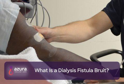 What Is a Dialysis Fistula Bruit?
