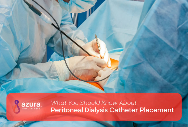 What to Know About Peritoneal Dialysis Catheter Placement