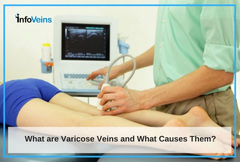 Do You Have Varicose Veins? Signs And Symptoms You Need To Know
