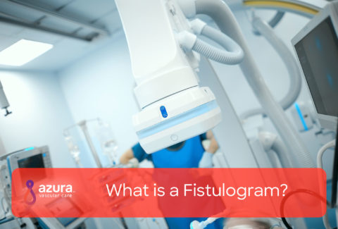 What is a Fistulogram?