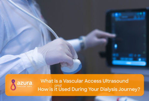 What is a Vascular Access Ultrasound and How is it Used During Your Dialysis Journey main image
