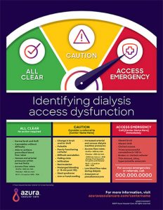 Identifying Dialysis Access Dysfunction