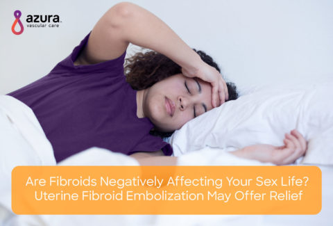 Are fibroids negatively affecting your sex life main image