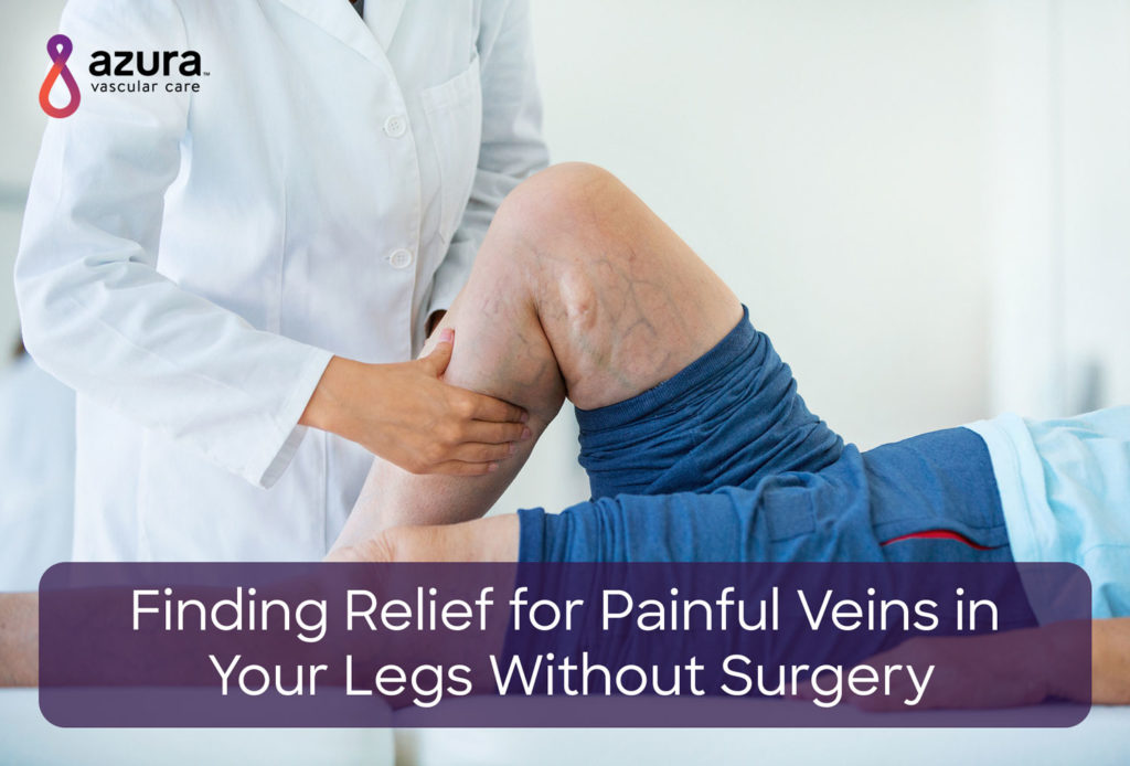 painful veins in legs main image