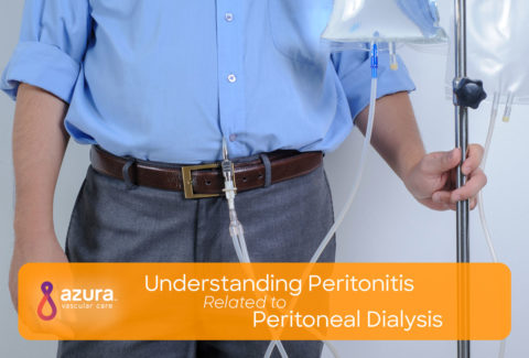 Peritonitis related to peritoneal dialysis