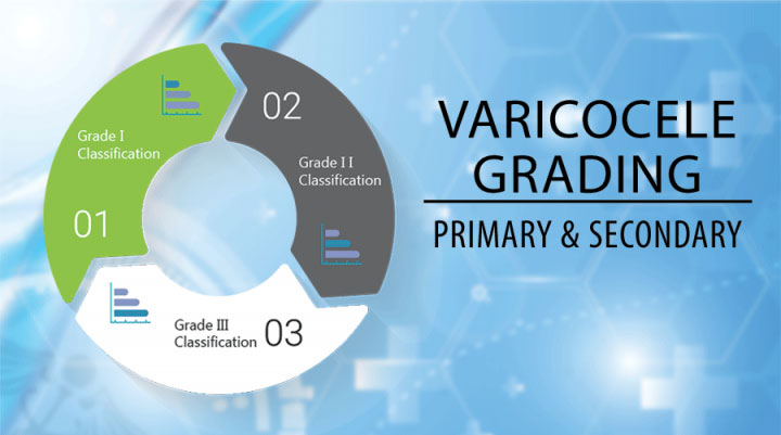 What Are The Different Grades of Varicocele? Primary And Secondary Varicocele