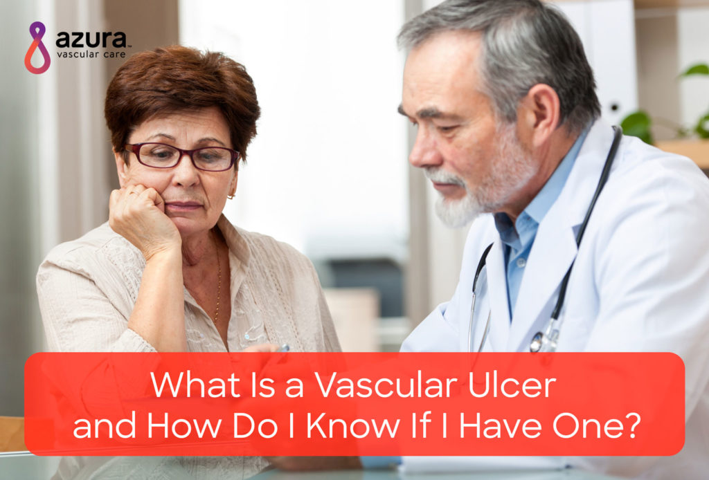 what is a vascular ulcer main image