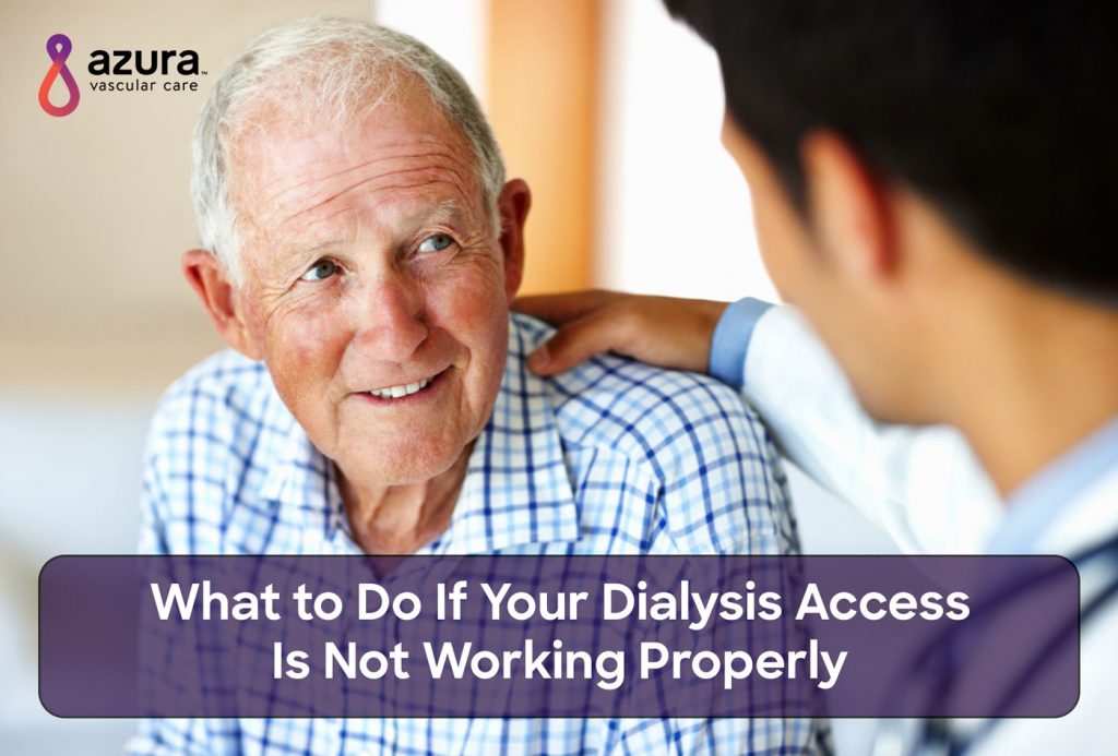 What to Do If Your Dialysis Access Is Not Working Properly